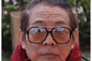 李连杰甲亢病情的早期症状与自我觉察，李连杰甲亢早期症状与自我觉察的关键启示